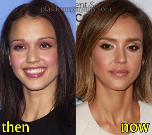 A picture of Jessica Alba before (left) and after (right).